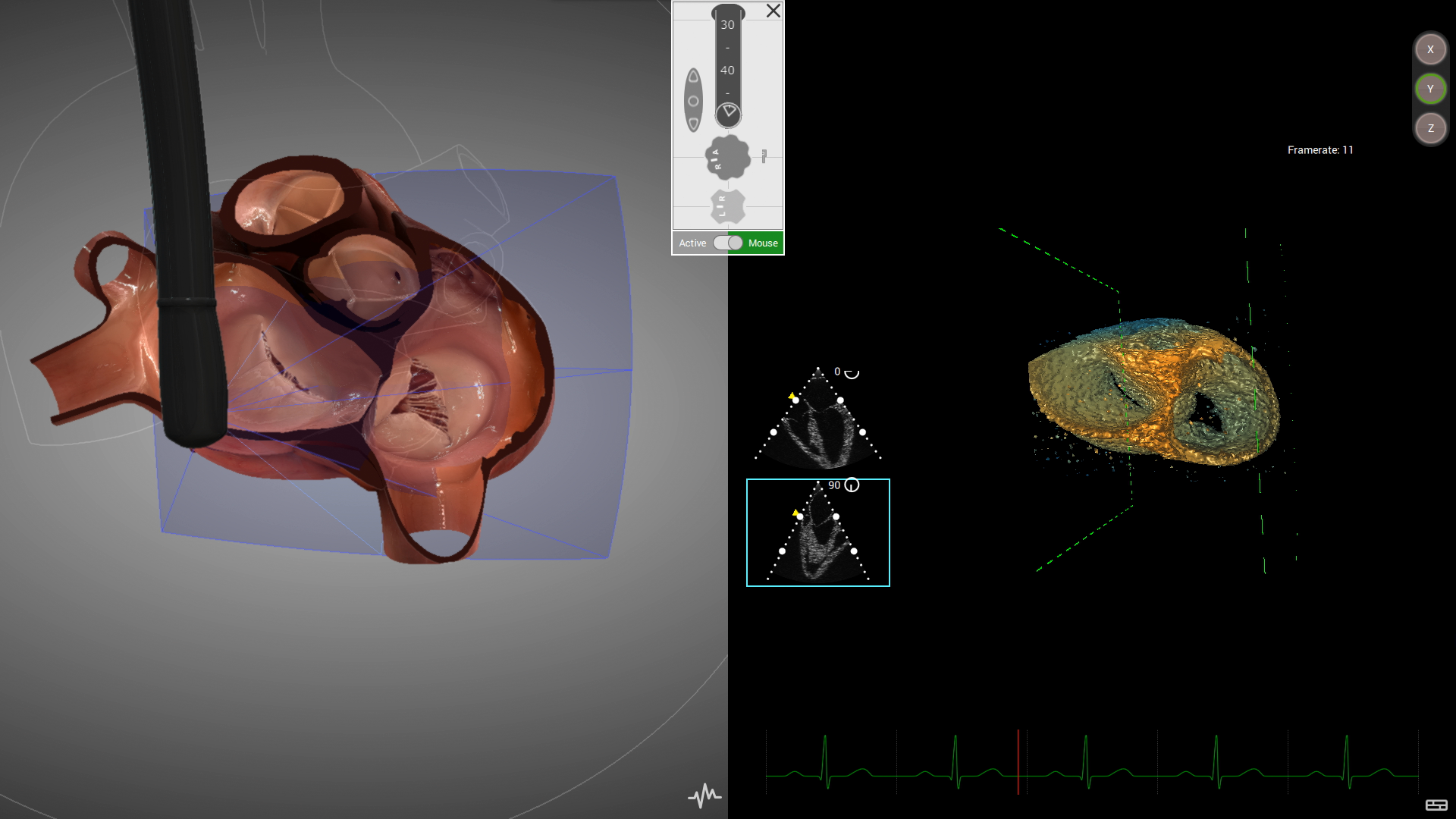 HeartWorks 3D echo - cropped