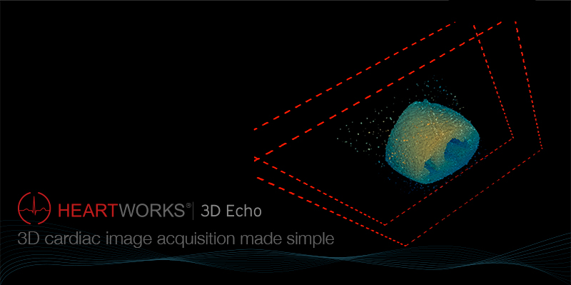 HeartWorks 3D Echo - 3D cardiac image acquisition made simple