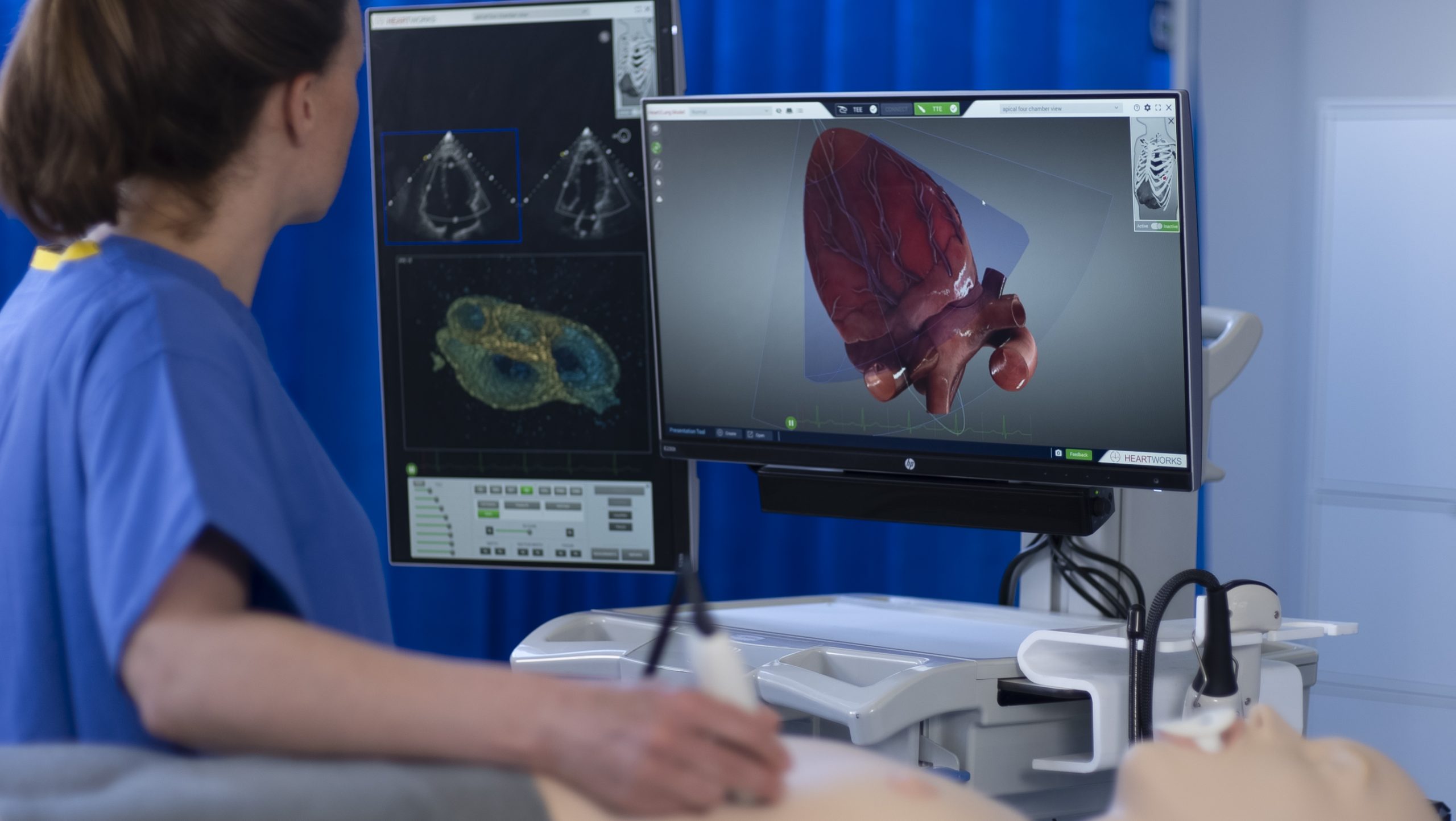 Virtual TEE: Standard Views, Cardiac, Transesophageal Echocardiography, 3D  Heart Model, Education