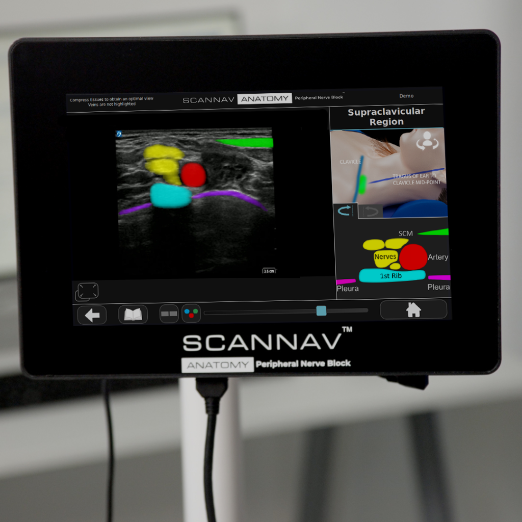 ScanNav™ Anatomy PNB